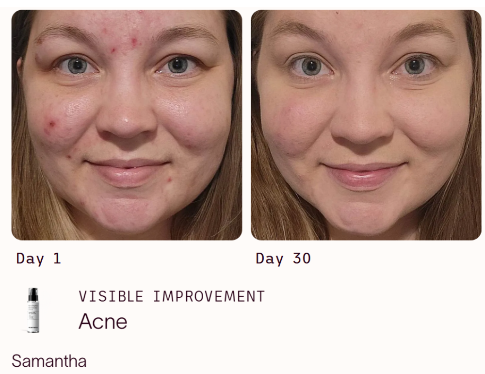 6 Peptide Skin Booster Serum