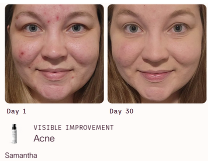 6 Peptide  Skin Booster Serum