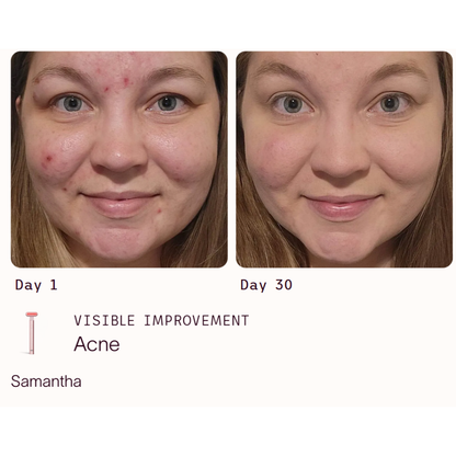 4-in-1 Radiant Renewal Skincare Wand with Red Light Therapy