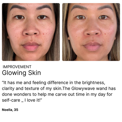 4-in-1 Radiant Renewal Skincare Wand with Red Light Therapy