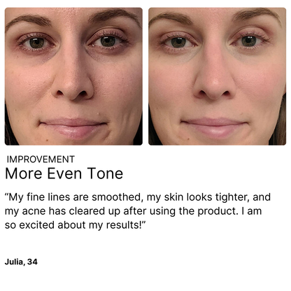 4-in-1 Radiant Renewal Skincare Wand with Red Light Therapy