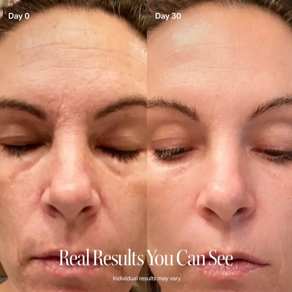 4-in-1 Radiant Renewal Skincare Wand with Red Light Therapy